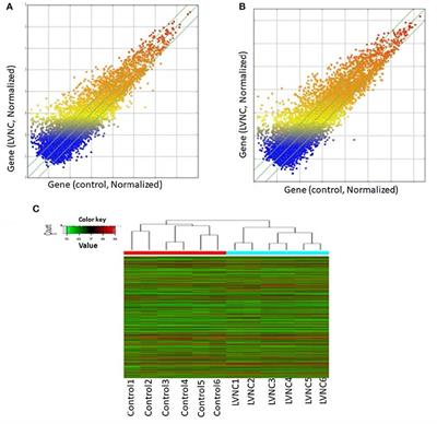 Expression Signatures of Long Noncoding RNAs in Left Ventricular Noncompaction